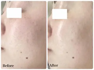 パーソナルエステ L'purのエステ・リラクイメージ