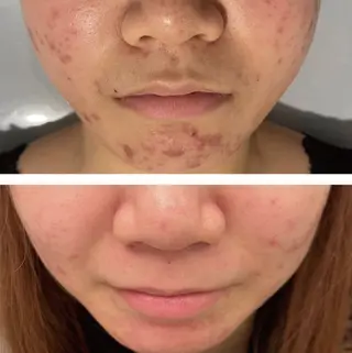 ナスサロ/看護師 おおほり🐰🫧のエステ・リラクイメージ