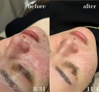 # fu♡のエステ・リラクイメージ