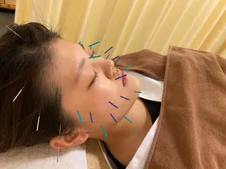 鍼灸サロン BBB3のその他イメージ