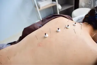 ここの はりきゅう治療院のエステ・リラクイメージ