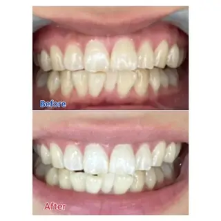 Ｍ渋谷 ホワイトニングのエステ・リラクイメージ