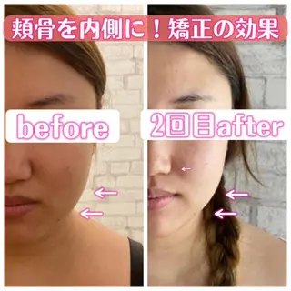 【小顔矯正】 salonaceのエステ・リラクイメージ