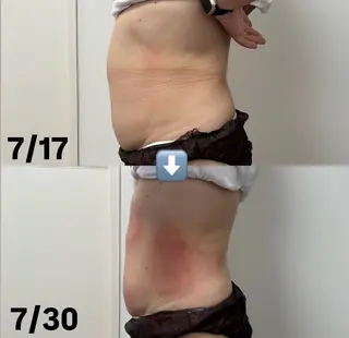 Miiju.所属・石巻 冷却痩身 Miiju. 鈴木のエステ・リラクイメージ