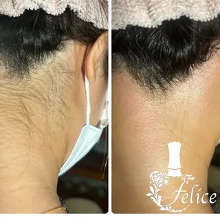 beauty salon felice所属・フェリーチェ 心斎橋のエステ・リラクイメージ