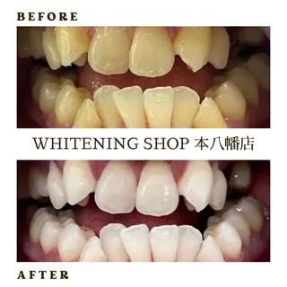 メンズ ホワイトニング ショップ本八幡店のエステ・リラクイメージ