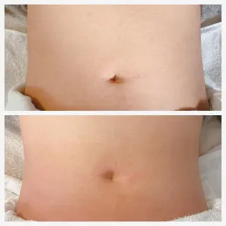 酒井 瑠未のエステ・リラクイメージ