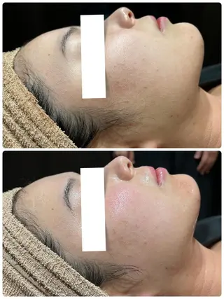 👑Linola👑 レイビス　纐纈のエステ・リラクイメージ