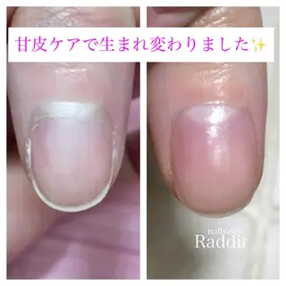 ネイル nailsalon Radditのネイルデザイン