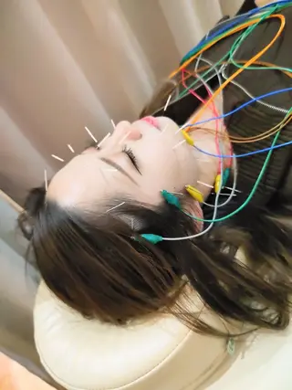 お顔のむくみたるみ 専門☆美容鍼小顔矯正のエステ・リラクイメージ