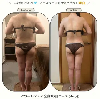 《本気痩せ×疲労改善 》  BILOOPのエステ・リラクイメージ