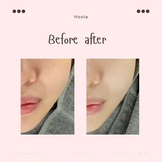 ハーブピーリング 〜Hoola〜のエステ・リラクイメージ