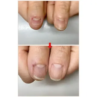 ネイル ネイルサロン アリュームのネイルデザイン
