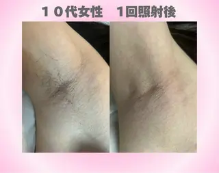 LED脱毛サロン 💐ayaのエステ・リラクイメージ