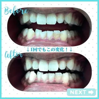 セルフホワイトニング COCOSHIROのエステ・リラクイメージ