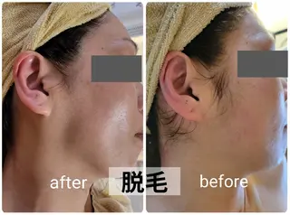 mindplus(マインドプラス)所属・mind plus 【小顔　痩身　脱毛】のエステ・リラクイメージ