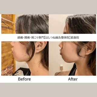 頭痛・腰痛・肩こり 特化してます。　橋岡のエステ・リラクイメージ