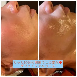 毛穴から始める肌メン テマンダリンオレンジのエステ・リラクイメージ
