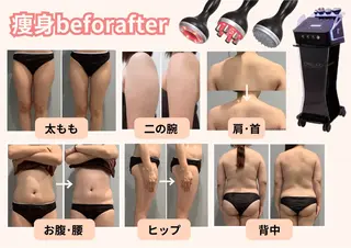 エステサロン JURISのエステ・リラクイメージ