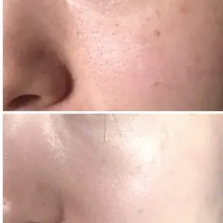 aliaハーブ水光店 エステティシャン募集のエステ・リラクイメージ