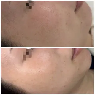 トータルしみケア専門 NICA(ニカ)の眉毛・アイブロウイメージ