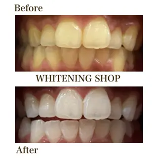 ホワイトニング ショップ 四条店のエステ・リラクイメージ