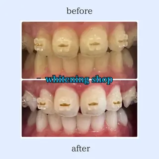 ホワイトニング ショップ伊丹店のその他イメージ