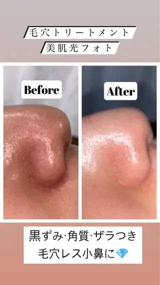 ミディアム カラー パーマ ヘアアレンジ メンズ キッズ ネイル マツエク・マツパ アイブロウ Chloe-クロエ- 脱毛/フェイシャルのエステ・リラクイメージ