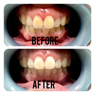 two nailのネイルデザイン