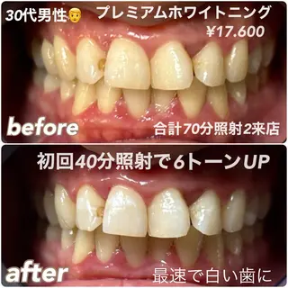 ホワイトニングビュー ティー西宮店のその他イメージ