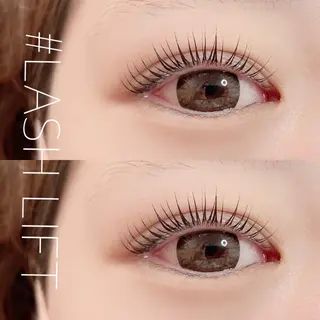 マツエク・マツパ 松井 亮子 (アイリスト)のエステ・リラクイメージ