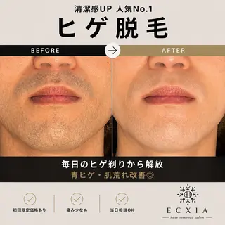 メンズ 《メンズ脱毛サロン》 博多 ECXIAのエステ・リラクイメージ