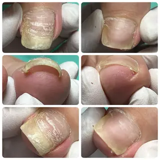 ネイル 巻き爪補正店 町田店のその他イメージ