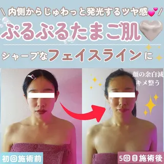 痩身ハーブピーリング 筋膜リリース☆B&Hのエステ・リラクイメージ