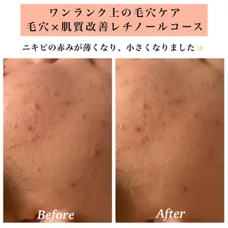 Bellesthe (ベルエステ)のエステ・リラクイメージ