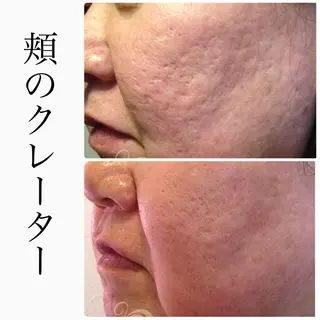 ハーブピーリング専門 BIOEL横浜のエステ・リラクイメージ