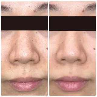 毛穴＆ホワイトニング mielのエステ・リラクイメージ