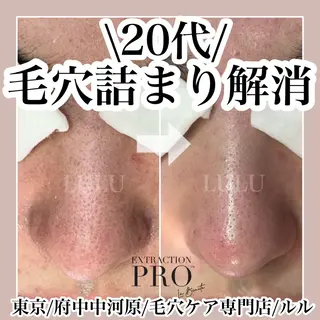 LULU ルルのエステ・リラクイメージ