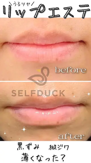 歯科提携セルフダック 宇都宮駒生店のエステ・リラクイメージ