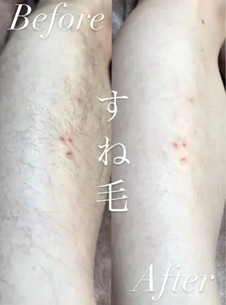 Hitomi シュガーリング豊橋のその他イメージ