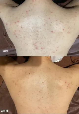 Fleur フルールのエステ・リラクイメージ