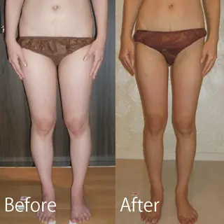 脚やせ専門ダイエット ルメートルのエステ・リラクイメージ