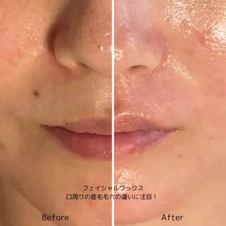 代表 MOMOのエステ・リラクイメージ