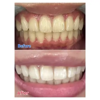 MBEAUTYSALON 千葉店・京成大久保所属・Melty 輝のその他イメージ