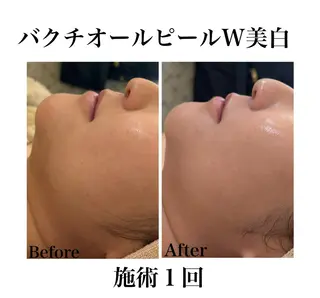 《美肌&小顔サロン》 Masqueradeのエステ・リラクイメージ