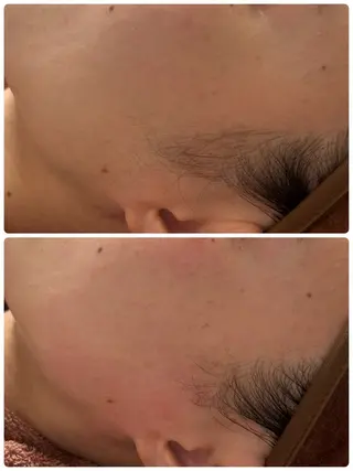 beauty  salon sorelle所属・産毛角質ケア/艶肌 フェイシャルワックスのエステ・リラクイメージ