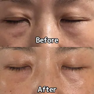 FERNABELL所属・岩本 ひなののエステ・リラクイメージ