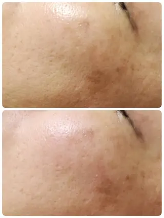 Astorie 相模大野エステのその他イメージ