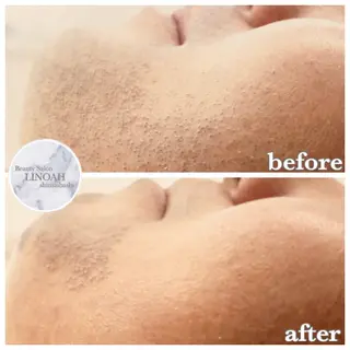 メンズ ビューティーサロン リノア心斎橋店のエステ・リラクイメージ