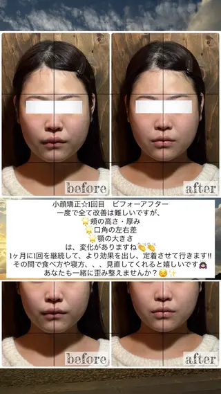 💎後悔させない小顔 矯正💎イトヤマ🌱のエステ・リラクイメージ